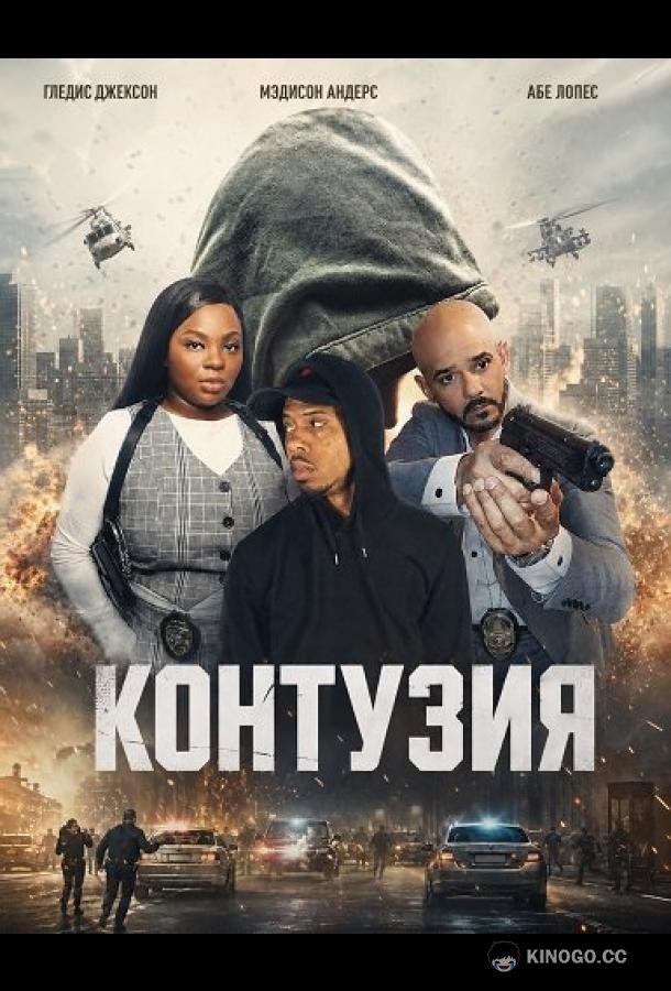 Контузия (2025) 